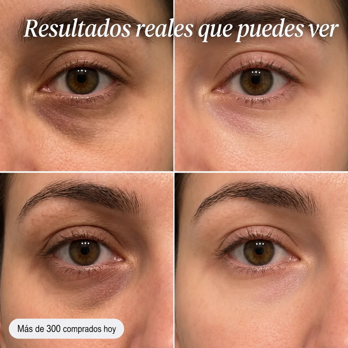 Bálsamo Hidratante de Colágeno | Tu Piel más Joven, Firme y Radiante